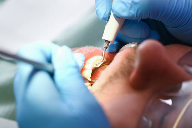 Best Cracked Tooth Emergency Dentist  in Crescent Springs, KY